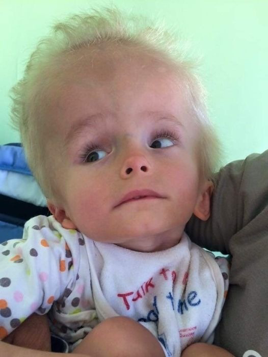 Dima, the child thrown by the mother like garbage! His parents didn’t even want to see him at birth because he looked too weird, they abandoned him at the first opportunity. But a few years later, something miraculous happened: Check the comments 👇👇👇