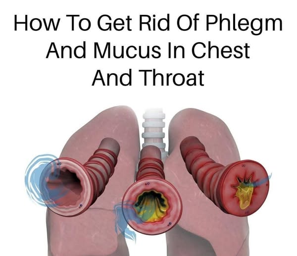 8 Ways To Get Rid Of Phlegm And Mucus In Chest And Throat. Method in the first (c.o.m.m.e.n.t.) 💬👀